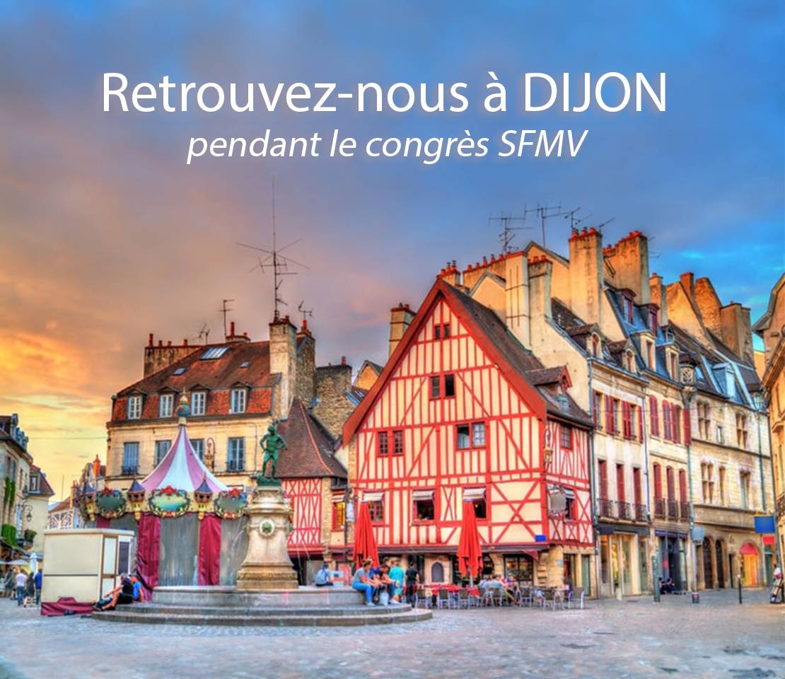 Rendez-vous à Dijon